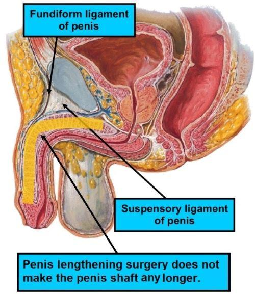 Diagram of the penile shaft and suspensory ligaments showing why dividing the ligament does not lengthen the erect shaft